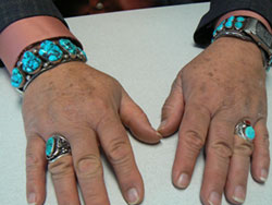 Scott Davis hands with turquois jewelry