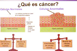 Que es cancer