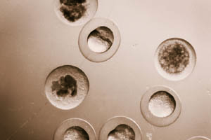 zebrafish eggs