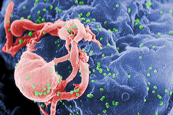 HIV photo